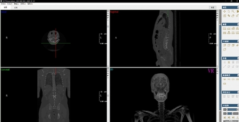 DCTViewer 开启医学三维分析新视界