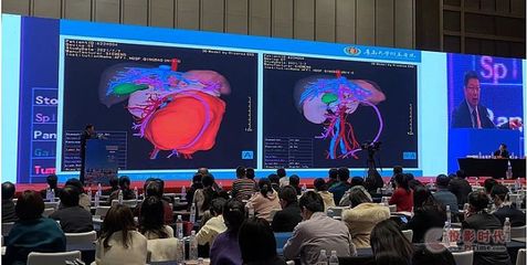 青大附院院长董蒨 海信CAS赋能医学三维分析，跻身世界最高医学科技舞台