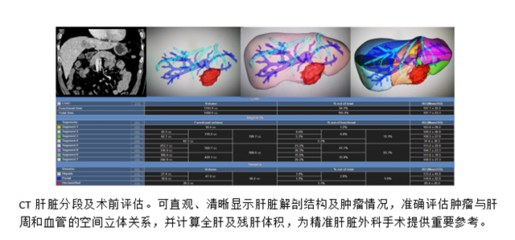3D可视化技术 外科手术的“GPS”